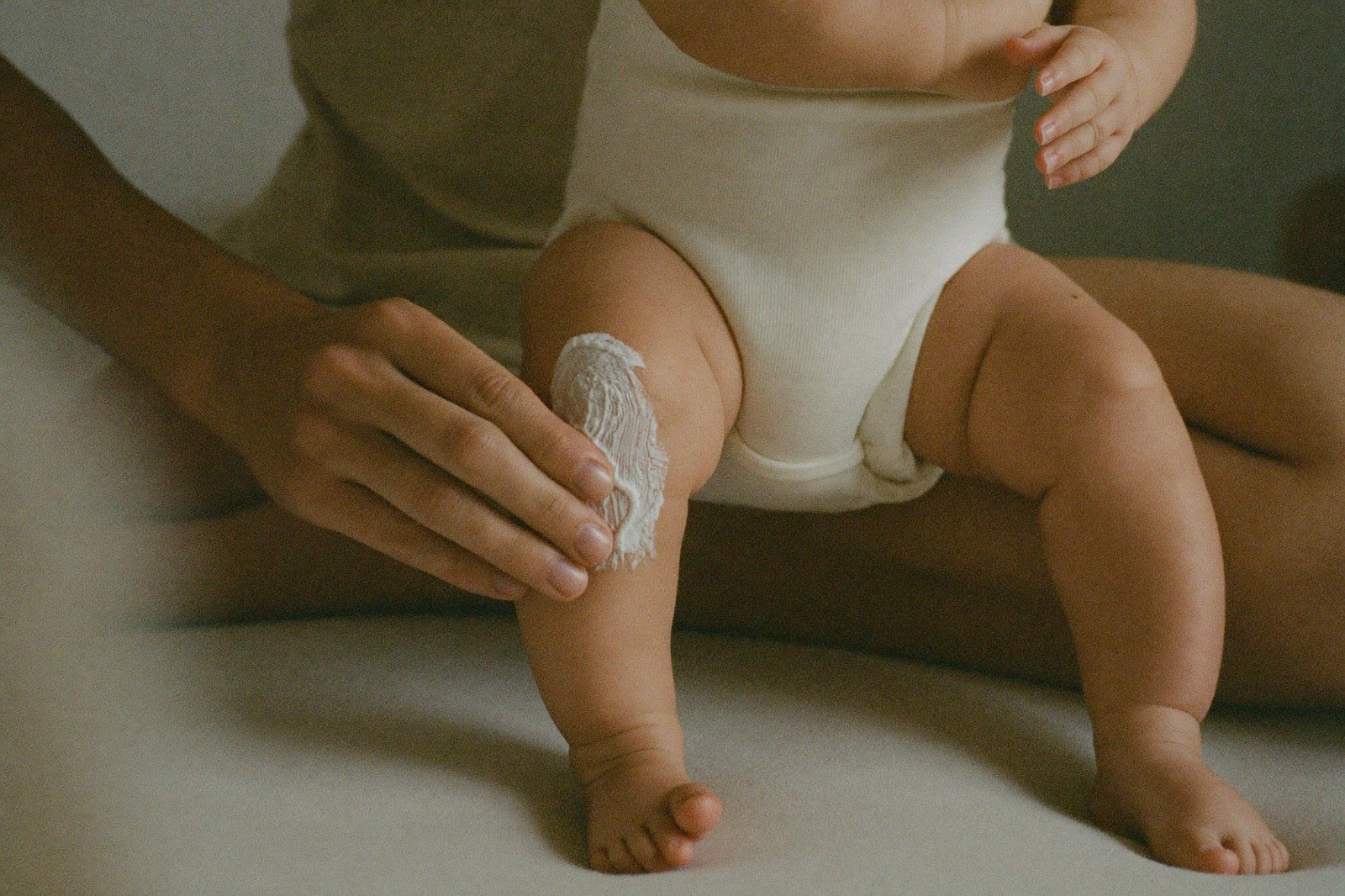 Mano de un adulto aplicando crema sobre la pierna de un bebé